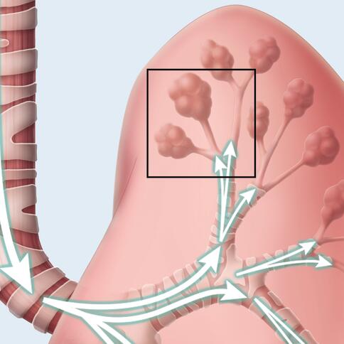 Illustration shows small and large airways within a lung